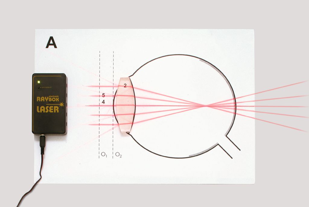 Laser Ray Box, magnethaftend